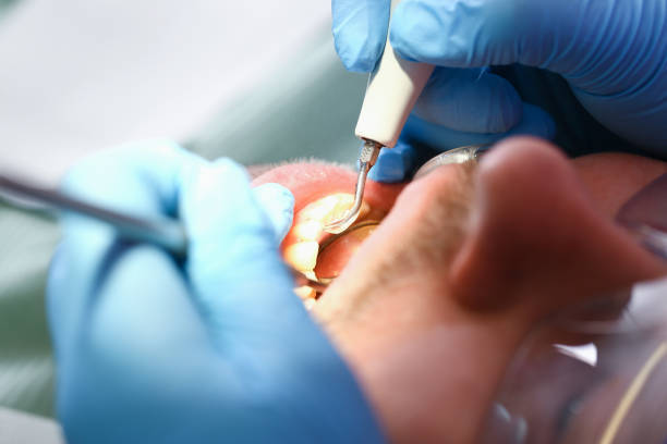 Best Emergency Dentist for Knocked-Out Tooth in Kaloko, HI